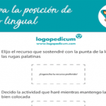 Register for lingual rest position