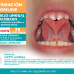Frenillo lingual alterado - De la evidencia científica a la práctica clínica (3a edición)