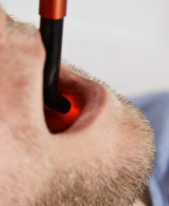 Láser Energy Laser L500 Pro con el cabezal intraoral colocado dentro de la boca de un paciente adulto