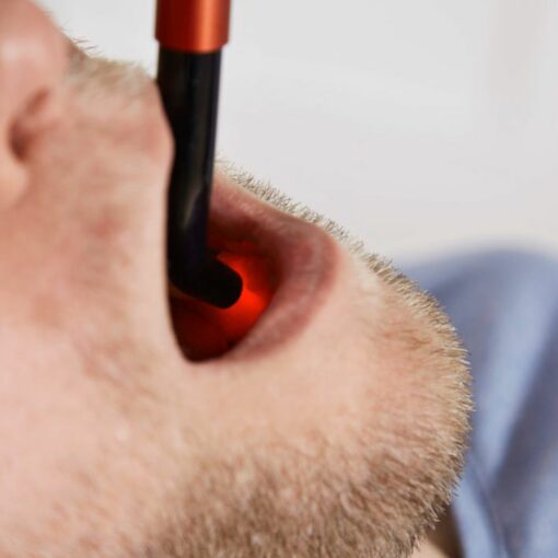 Láser Energy Laser L500 Pro con el cabezal intraoral colocado dentro de la boca de un paciente adulto